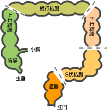 大腸 が ん に なり やすい 食べ物